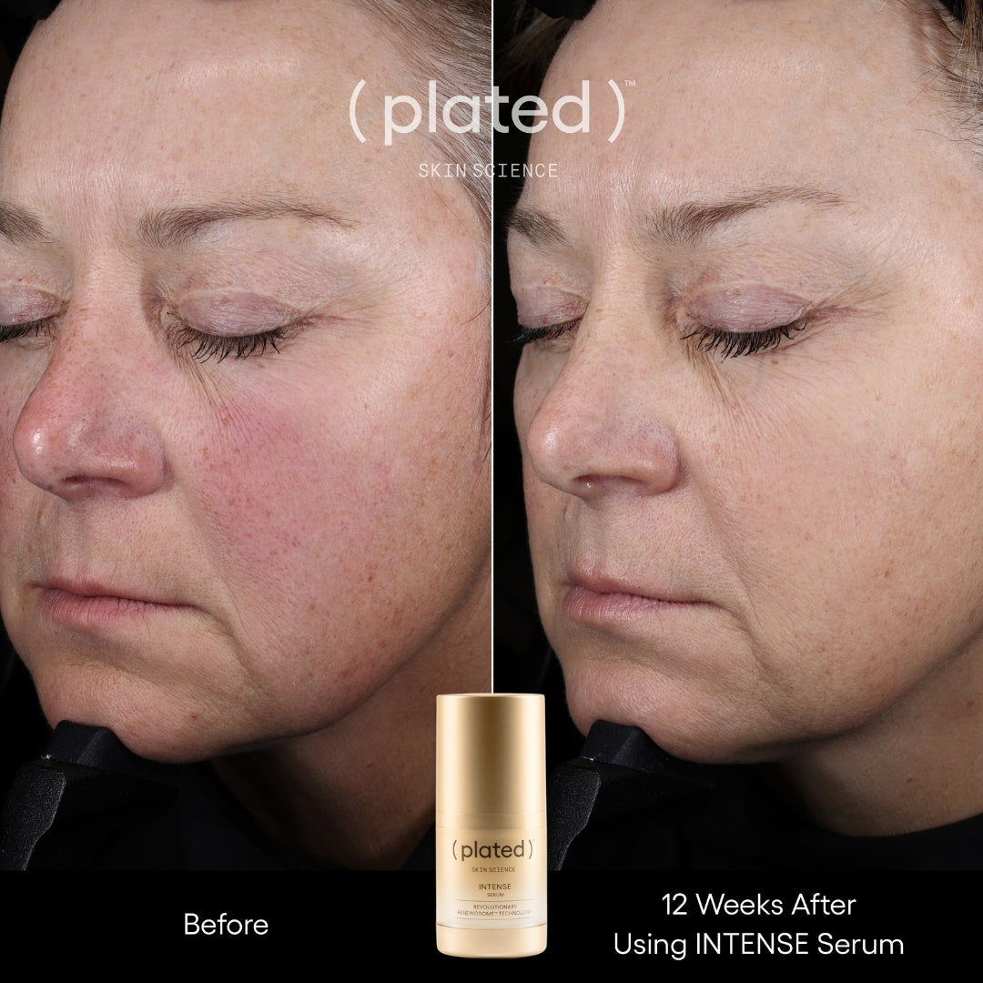 Plated INTENSE Serum